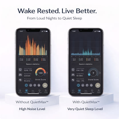 QuietMax™ – Adjustable Quiet Sleep Mouthpiece